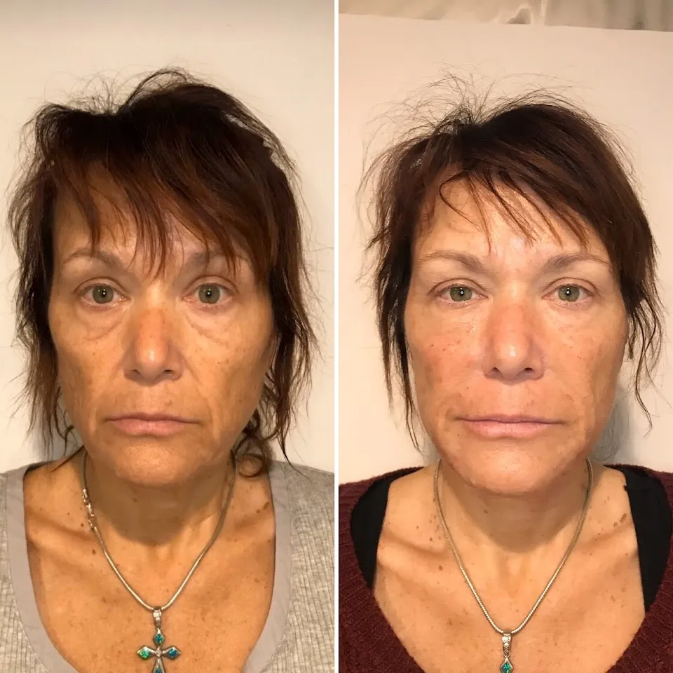 BEAUTIFY Medical Spa