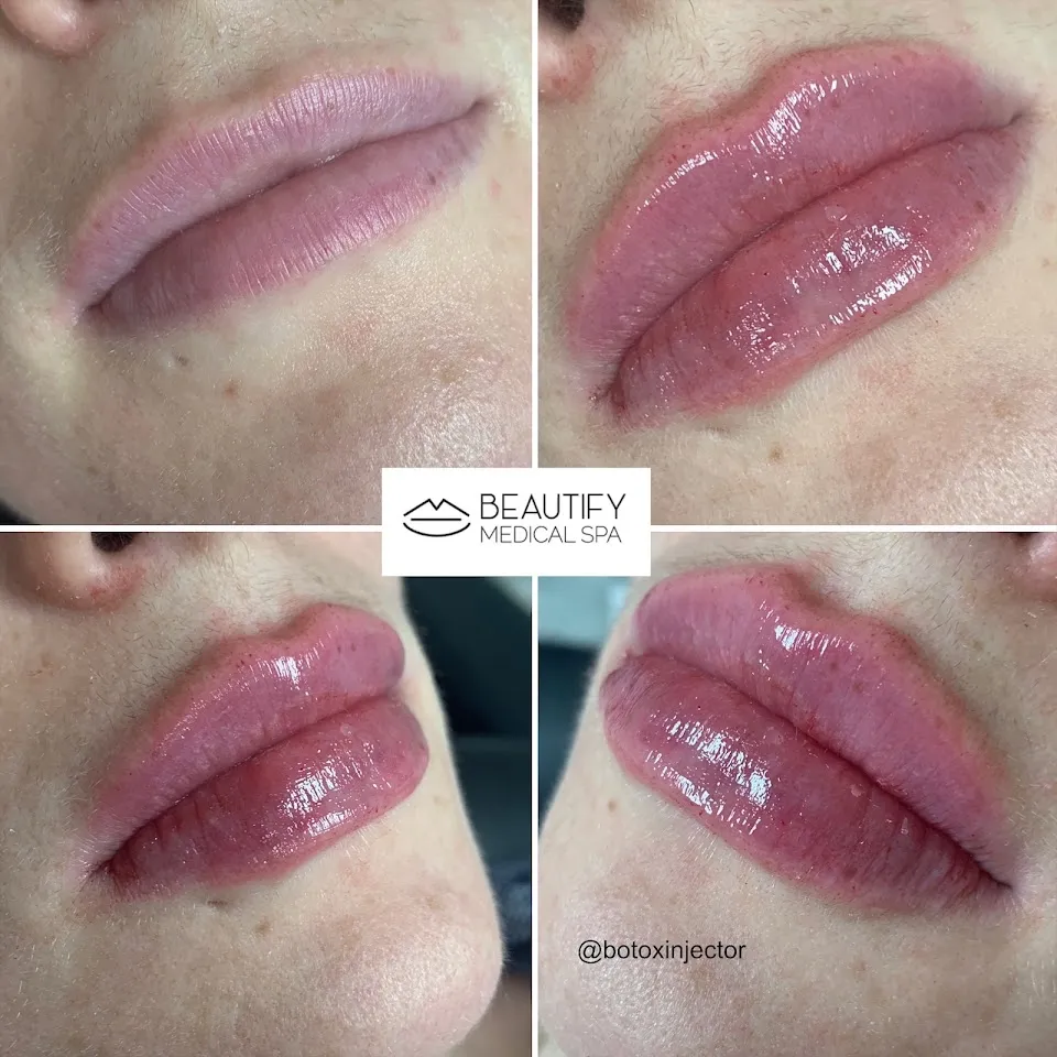 BEAUTIFY Medical Spa