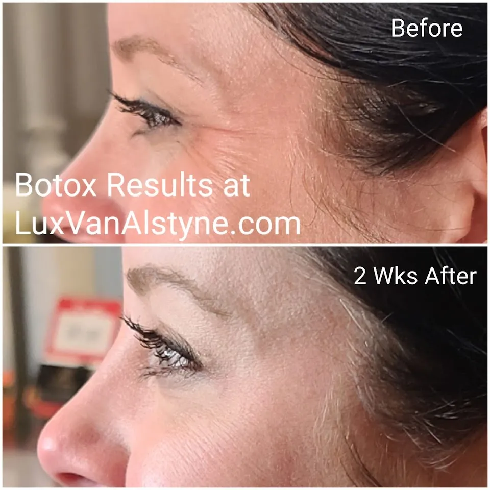 LUX AESTHETIC MEDSPA / CLAYTON, GEORGIA