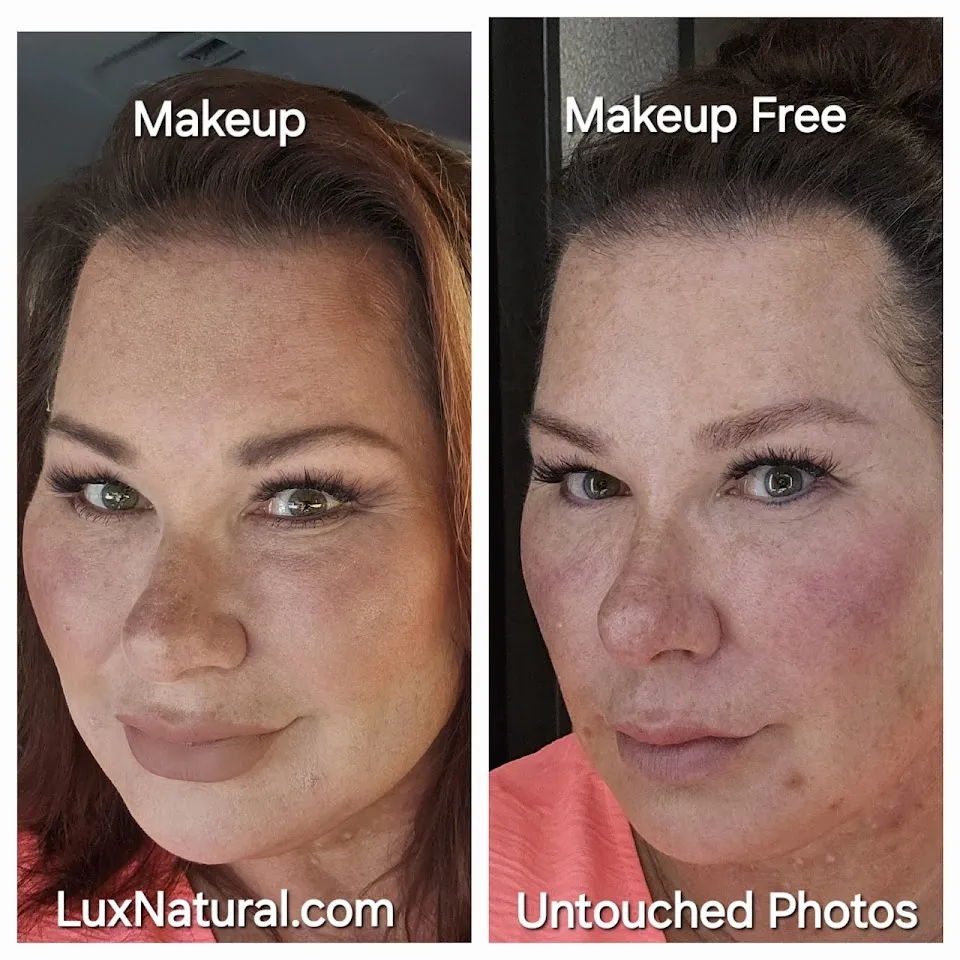 LUX AESTHETIC MEDSPA / CLAYTON, GEORGIA
