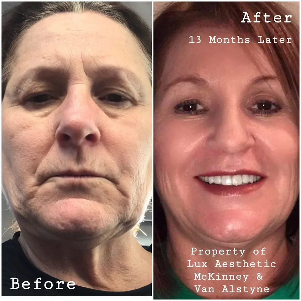 LUX AESTHETIC MEDSPA / CLAYTON, GEORGIA