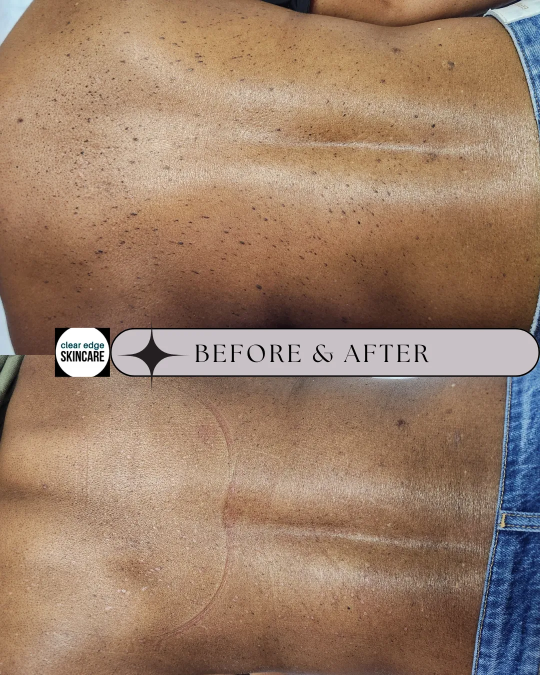 Clear Edge Skincare